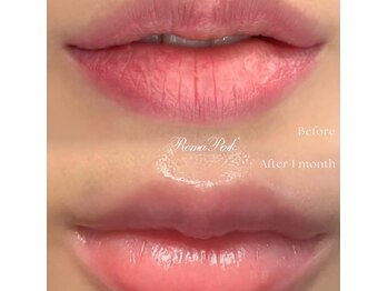 パナケイア(PANAKCEA)