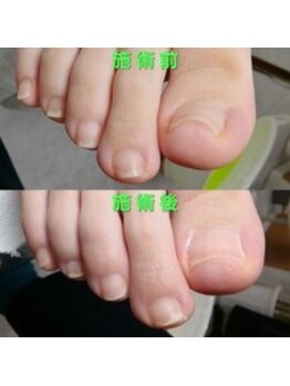 【美爪ケア】ネイル/フット