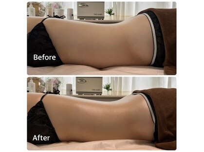 ルネ(Rune)の写真