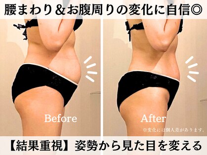 サンティエールの写真