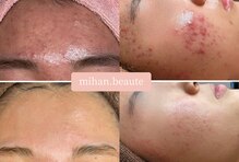 ミハン ボーテ(mihan.beaute)