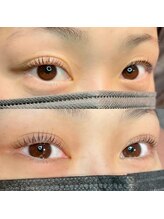 エフラッシュ 桜木町(F-lash)/エグータム2ヶ月使用