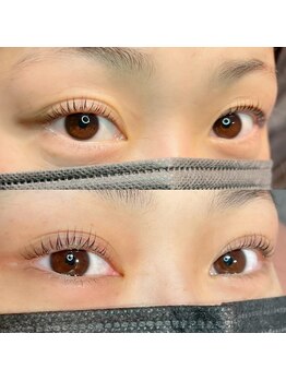 エフラッシュ 桜木町(F-lash)/エグータム2ヶ月使用