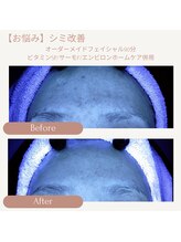 プリマジュール/シミ、頬のたるみに働きかける！