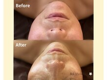 バリマ ビューティー(Bali Ma'beauty)/【小顔コルギ/かっさ＆EMS】