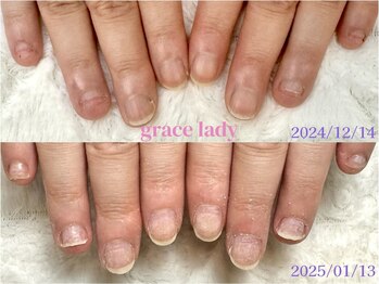 グレースレディ 大阪店/(深爪/長さだし/フィルイン/)