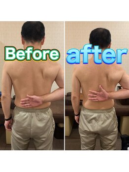 きのき接骨院/筋膜リリース