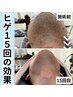【効果を感じられなかった方向け】初回カウンセリング＋ヒゲ脱毛1回¥5,900