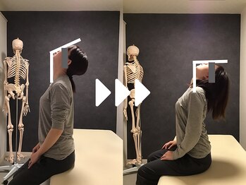 ミライズ整体院 三宮本院/事例【20代女性・首のこり】