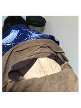 リー(Re)/施術例【腰痛鍼施術】