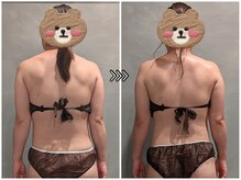 ツーアップ(2up)/もっこり肩,猫背巻き肩