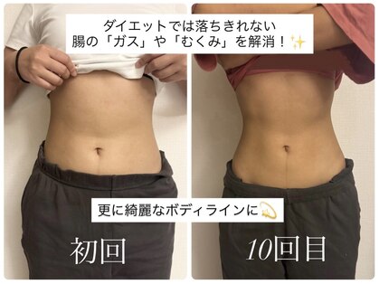 ネネ(Nene)の写真