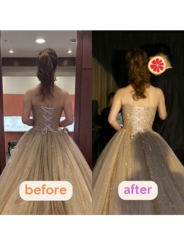 グレフル鍼灸接骨院 整体院 心斎橋/ブライダル/肩甲骨はがし/美鎖骨