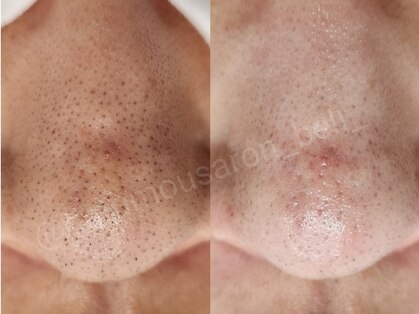 脱毛サロン ベル(Bell)の写真