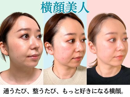 ナチュラルパーフェクトフェイス 新宿の写真