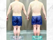 パラディ(PARADIS)/ハイパーナイフ/シェイプ