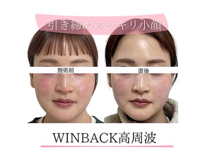 タルボ(TALBO)の写真