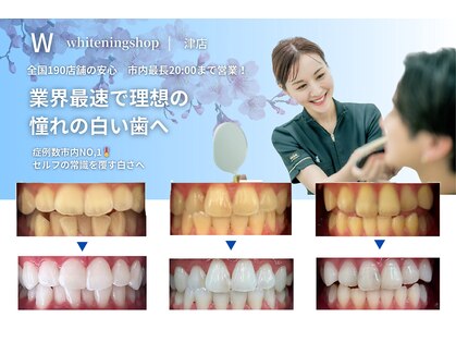 ホワイトニングショップ 津店の写真