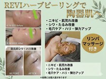 ルアナ(Luana)の雰囲気（Instagram、Youtubeでも話題☆REVIハーブピーリング☆肌質改善！）