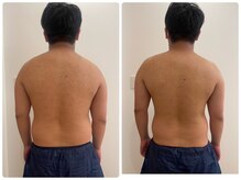 ルナグランデ(Luna grande.)/脂肪分解10mlでウエスト引き締め