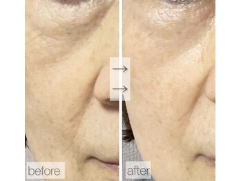 グリーンノート(GREEN NOTE)/ヒト臍帯血細胞培養液65%