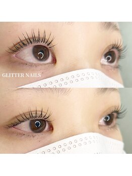 グリッターネイル(GLITTER NAILS)/アンドヘルシー