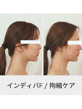リムビューティー 自由が丘(RymBeauty)/インディバ 拘縮ケア