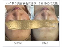 ナイングラム(ninegram)/