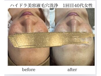 ナイングラム(ninegram)/