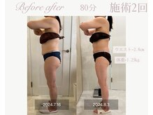 パルタージュ(Partage)/デトックス痩身エステ