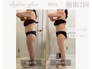 パルタージュ(Partage)/デトックス痩身エステ