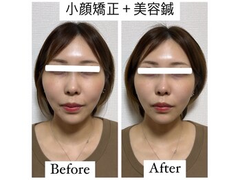 スゥルシエル(Sous le ciel)/