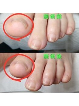 【美爪ケア】ネイル/フット