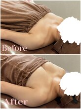 ロココ 大宮店(Rococo)/施術10回目【A→Dカップへ】