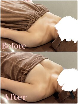 ロココ 大宮店(Rococo)/施術10回目【A→Dカップへ】