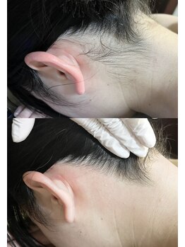 十美/【後ろ美人♪】before　after