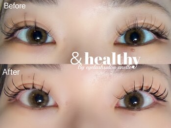 アネロ(anello)/＆healthy 