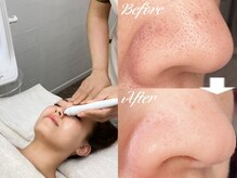 スリーラボ(THREE-Labo)の雰囲気（毛穴洗浄/ハーブピーリング/テラーボーラー（EMS）/エクソソーム）