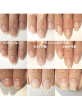 ニコプラス(NICO+)/自爪育成パラジェルクリア補強