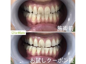 ルブラン 奈良店(Le Blanc)/目に見えるその汚れ