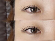 ベベ(bebe)/アンドヘルシー140本