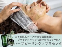 アネラ 新宿店(ANELA)の雰囲気（敏感肌や肌荒れでお悩みの方はハーブピーリングで肌質改善◎）
