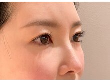 ヴィタエ(VITAE)/自然に溶け込む美まつげ