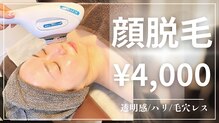 ウィロー