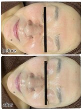 シャルマン/口元から若見え印象