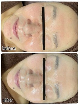 シャルマン/口元から若見え印象