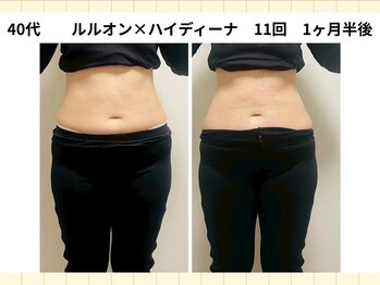 ヨサパーク ルルア(YOSA PARK Lulua)の写真/【痩せない原因に集中アタック！】進化系よもぎ蒸し×深部リンパマッサージで温活痩身◎理想の美ボディへ
