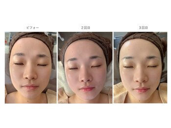 ケンジョビューティーサロン(Kenjo &nbsp;Beauty Salon)の写真/【結果重視の方必見☆】ベテラン施術者による施術で小顔も美肌もスッキリとした理想のフェイスラインを◎