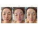 ケンジョビューティーサロン(Kenjo &nbsp;Beauty Salon)の写真/【結果重視の方必見☆】ベテラン施術者による施術で小顔も美肌もスッキリとした理想のフェイスラインを◎