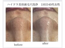 ナイングラム(ninegram)/